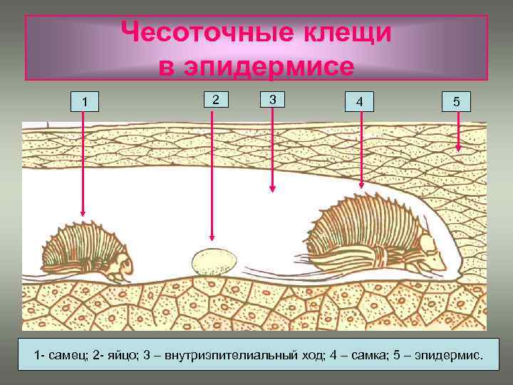 Чесоточный зудень рисунок с подписями