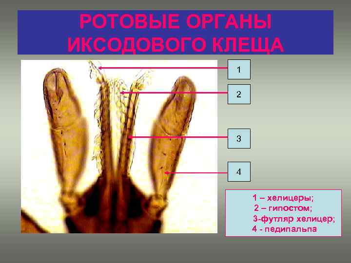 РОТОВЫЕ ОРГАНЫ ИКСОДОВОГО КЛЕЩА 1 2 3 4 1 – хелицеры; 2 – гипостом;