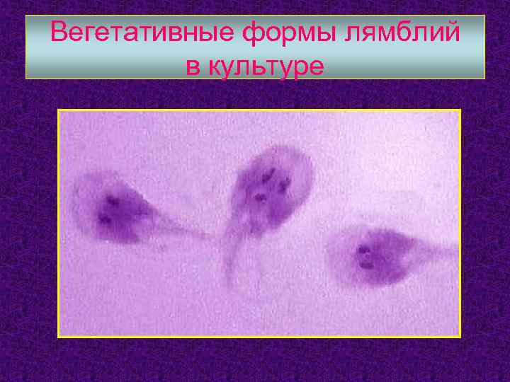 Вегетативные формы лямблий в культуре 