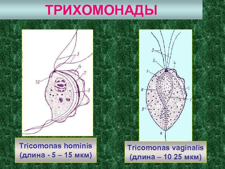 Трихомонада влагалищная фото