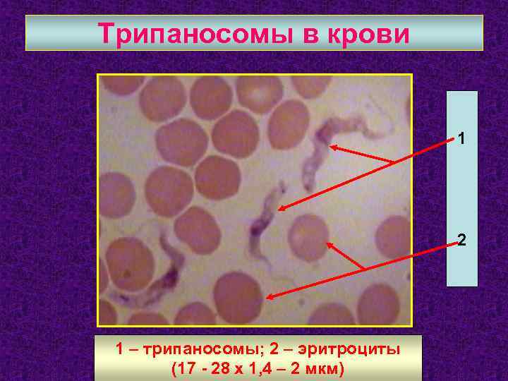 Трипаносомы в крови 1 2 1 – трипаносомы; 2 – эритроциты (17 - 28