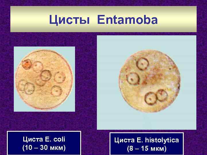 Цисты Entamoba Циста E. coli (10 – 30 мкм) Циста E. histolytica (8 –