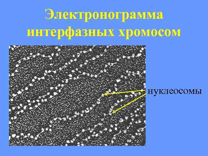 Электронограмма интерфазных хромосом нуклеосомы 