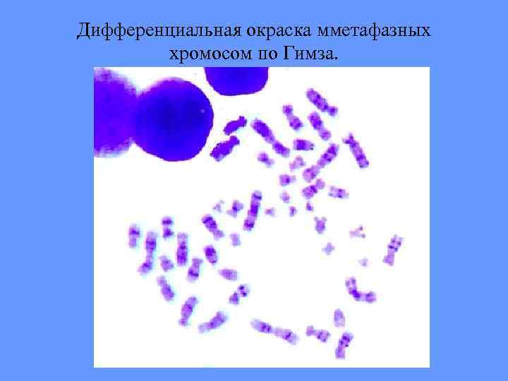 Дифференциальная окраска мметафазных хромосом по Гимза. 