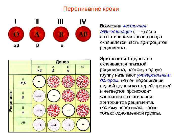 Переливание крови Возможна частичная агглютинация (— +) если агглютининами крови донора склеивается часть эритроцитов