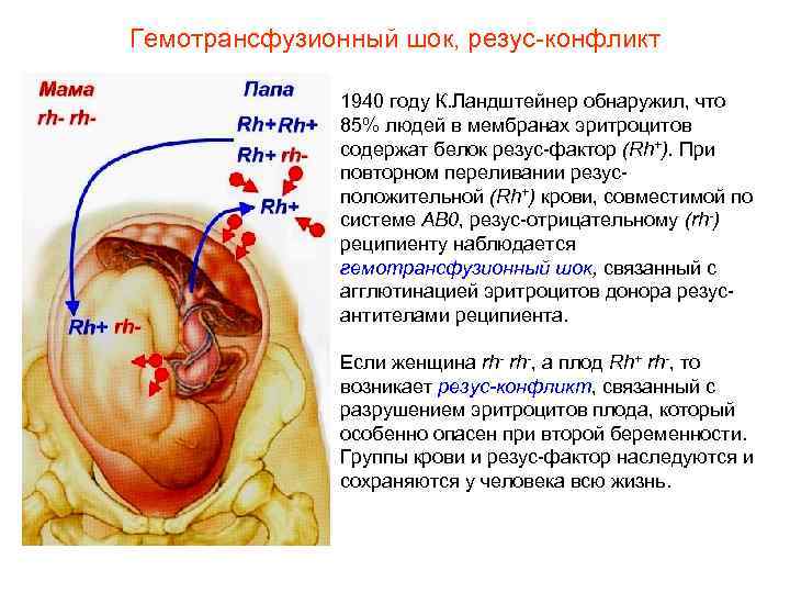 Гемотрансфузионный шок, резус-конфликт 1940 году К. Ландштейнер обнаружил, что 85% людей в мембранах эритроцитов