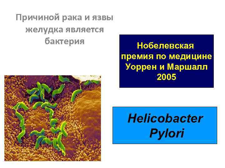 Причиной рака и язвы желудка является бактерия Нобелевская премия по медицине Уоррен и Маршалл
