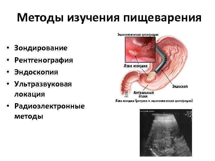 Методы изучения пищеварения Зондирование Рентгенография Эндоскопия Ультразвуковая локация • Радиоэлектронные методы • • 