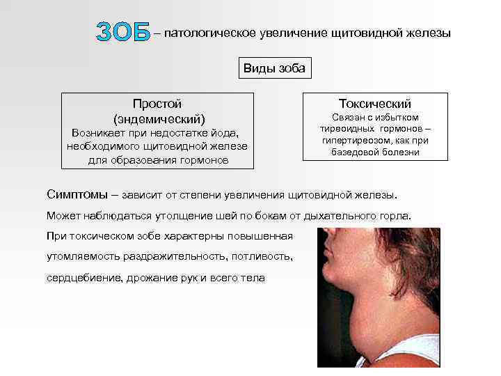 – патологическое увеличение щитовидной железы Виды зоба Простой (эндемический) Возникает при недостатке йода, необходимого
