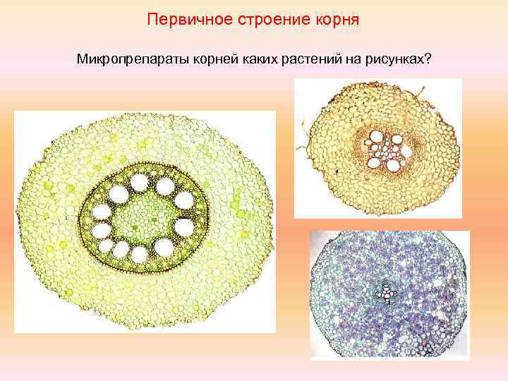 Первичное строение корня Микропрепараты корней каких растений на рисунках? 