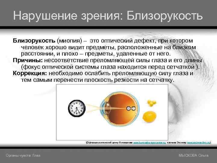 Нарушение зрения: Близорукость (миопия) – это оптический дефект, при котором человек хорошо видит предметы,