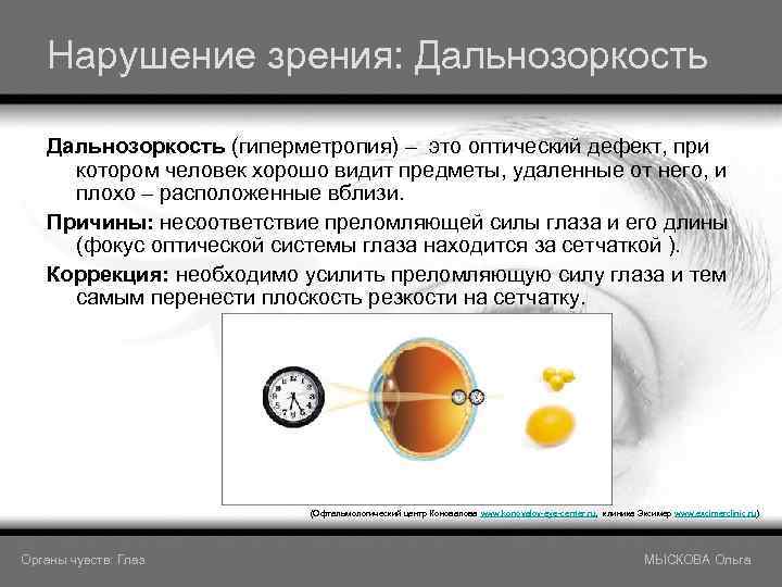 Нарушение зрения: Дальнозоркость (гиперметропия) – это оптический дефект, при котором человек хорошо видит предметы,