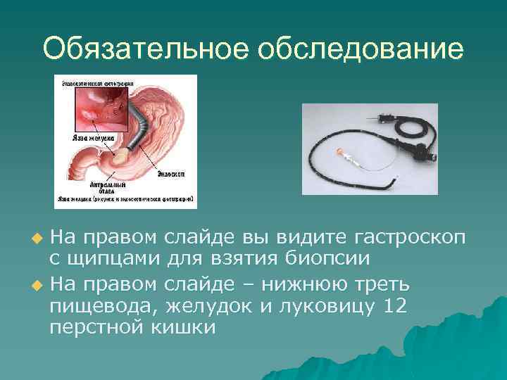 Обязательное обследование На правом слайде вы видите гастроскоп с щипцами для взятия биопсии u
