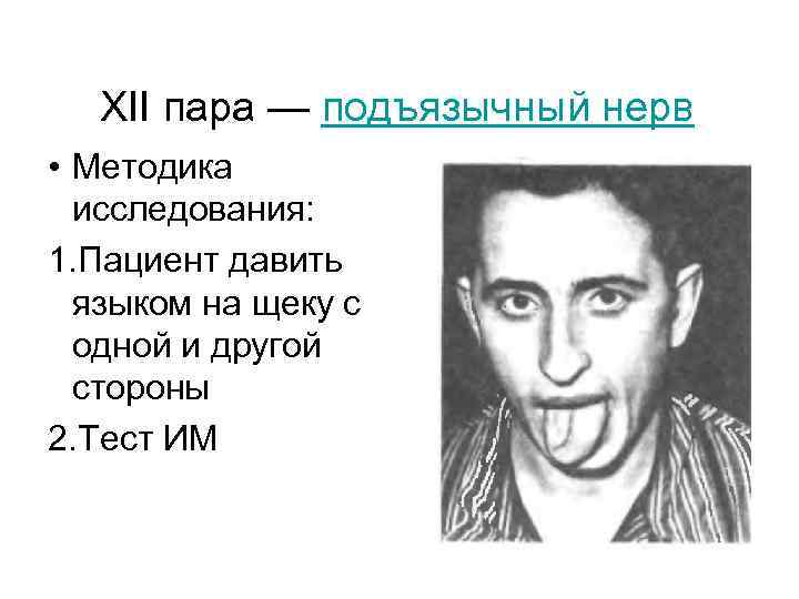 XII пара — подъязычный нерв • Методика исследования: 1. Пациент давить языком на щеку