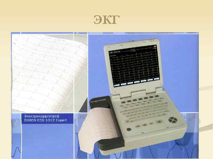 ЭКГ 