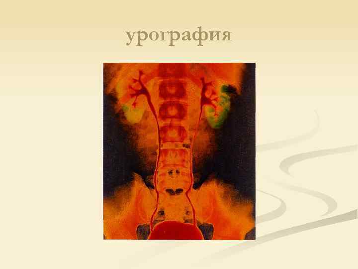 урография 