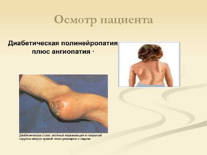 Осмотр пациента 