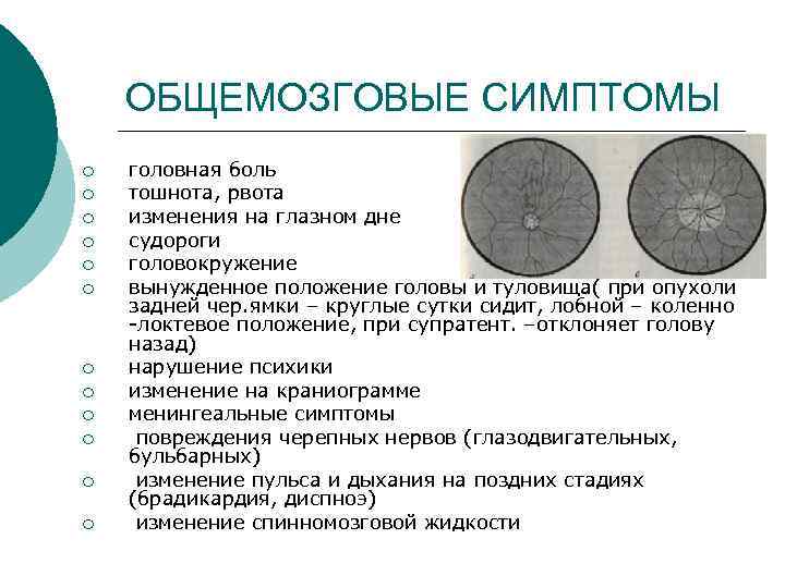 ОБЩЕМОЗГОВЫЕ СИМПТОМЫ ¡ ¡ ¡ головная боль тошнота, рвота изменения на глазном дне судороги