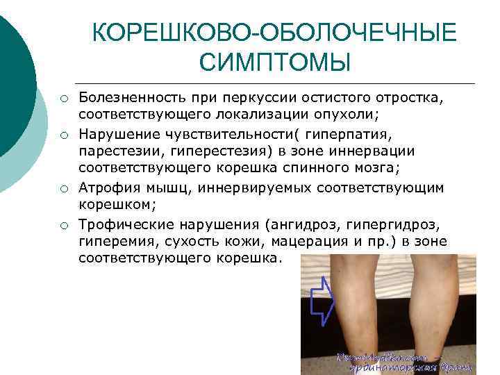 КОРЕШКОВО-ОБОЛОЧЕЧНЫЕ СИМПТОМЫ ¡ ¡ Болезненность при перкуссии остистого отростка, соответствующего локализации опухоли; Нарушение чувствительности(