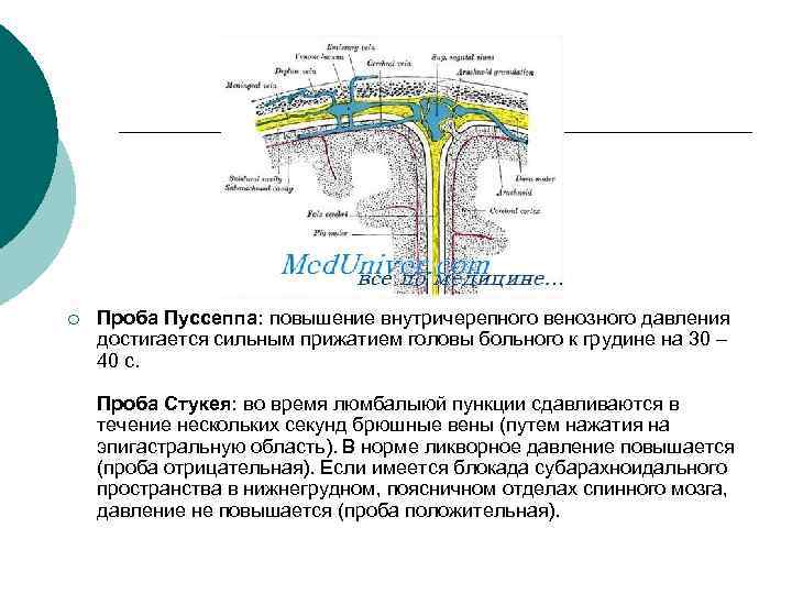 ¡ Проба Пуссеппа: повышение внутричерепного венозного давления достигается сильным прижатием головы больного к грудине