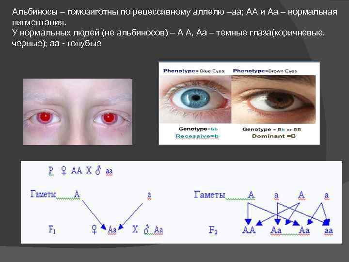 Альбиносы – гомозиготны по рецессивному аллелю –аа; АА и Аа – нормальная пигментация. У