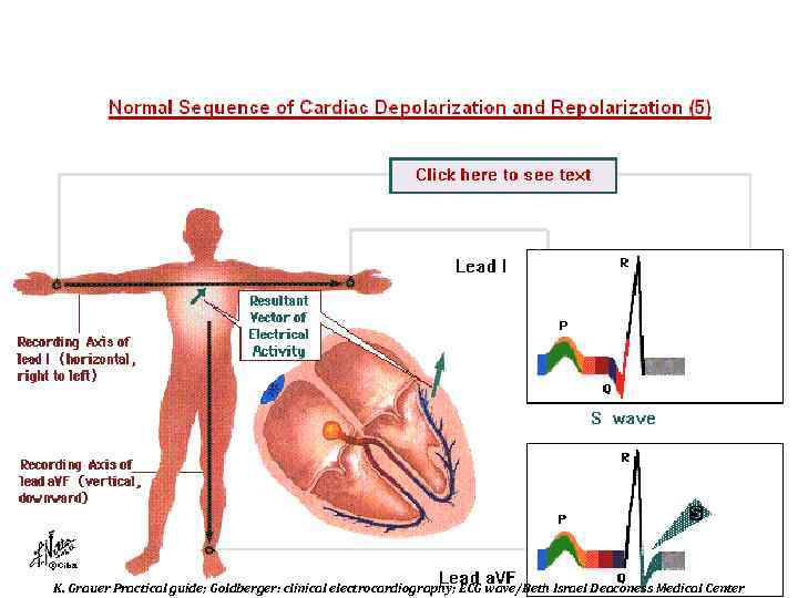 K. Grauer Practical guide; Goldberger: clinical electrocardiography; ECG wave/Beth Israel Deaconess Medical Center 