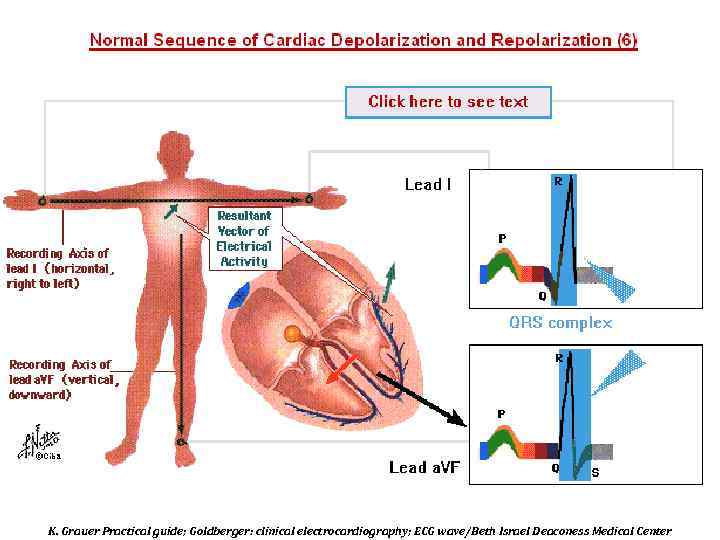 K. Grauer Practical guide; Goldberger: clinical electrocardiography; ECG wave/Beth Israel Deaconess Medical Center 