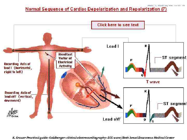 K. Grauer Practical guide; Goldberger: clinical electrocardiography; ECG wave/Beth Israel Deaconess Medical Center 