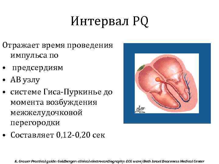 Интервал PQ Отражает время проведения импульса по • предсердиям • АВ узлу • системе