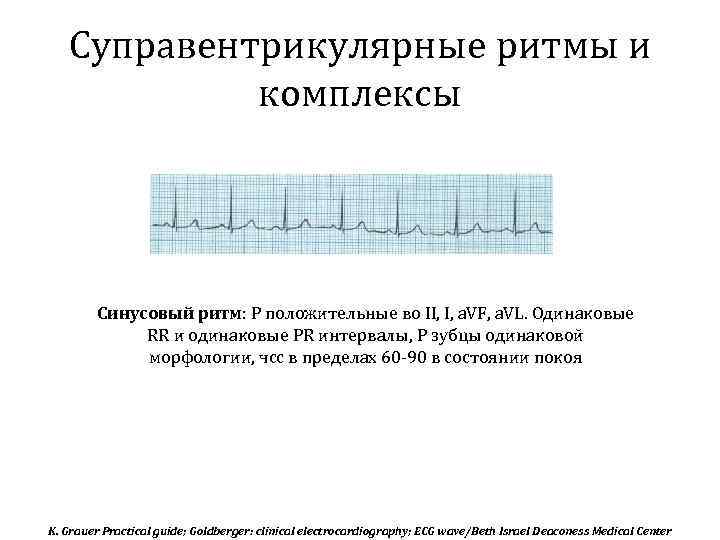 Суправентрикулярная тахикардия карта вызова смп