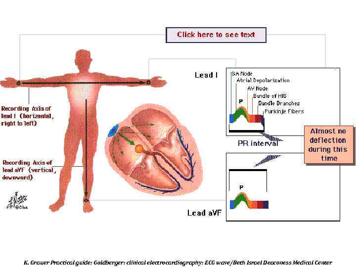 K. Grauer Practical guide; Goldberger: clinical electrocardiography; ECG wave/Beth Israel Deaconess Medical Center 