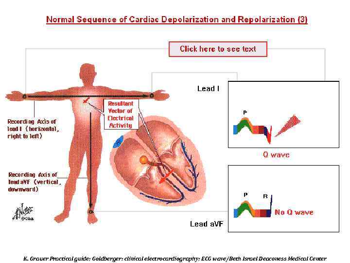 K. Grauer Practical guide; Goldberger: clinical electrocardiography; ECG wave/Beth Israel Deaconess Medical Center 