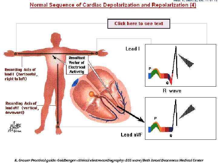 K. Grauer Practical guide; Goldberger: clinical electrocardiography; ECG wave/Beth Israel Deaconess Medical Center 