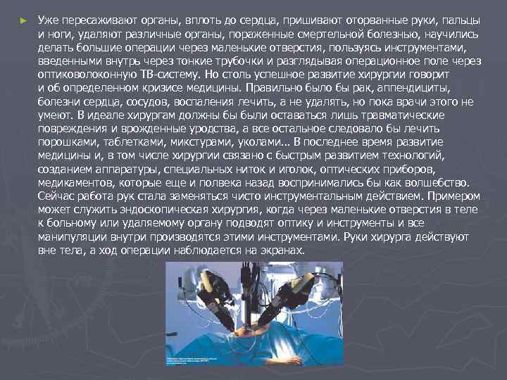 ► Уже пересаживают органы, вплоть до сердца, пришивают оторванные руки, пальцы и ноги, удаляют