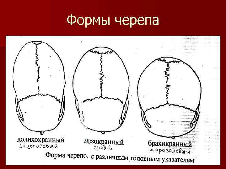 Варианты формы черепа