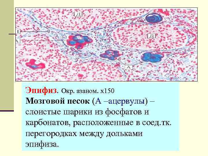 Эпифиз рисунок гистология