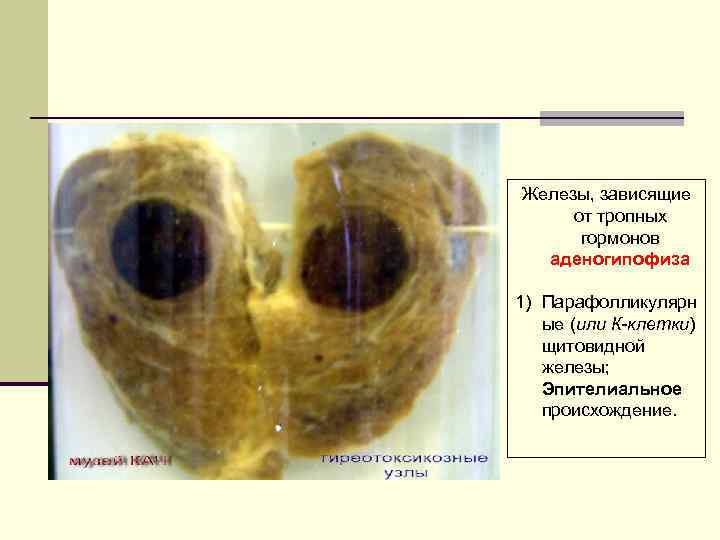 Железы, зависящие от тропных гормонов аденогипофиза 1) Парафолликулярн ые (или К-клетки) щитовидной железы; Эпителиальное