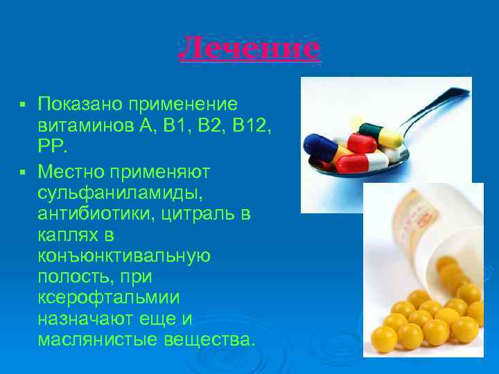 Лечение Показано применение витаминов А, В 1, В 2, В 12, РР. § Местно