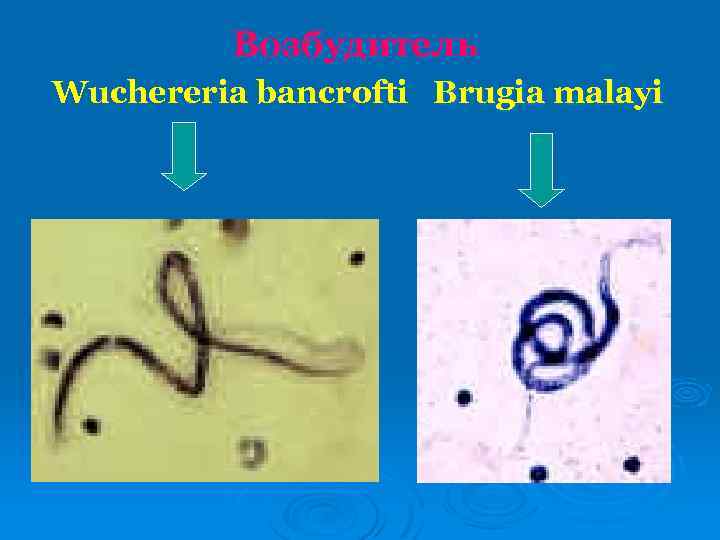 Возбудитель Wuchereria bancrofti Brugia malayi 