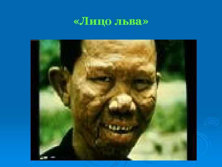  «Лицо льва» 