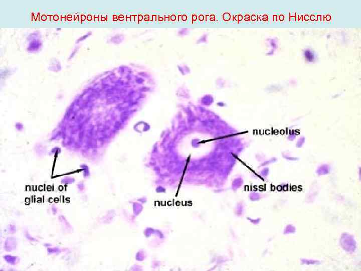 Мотонейроны вентрального рога. Окраска по Нисслю 