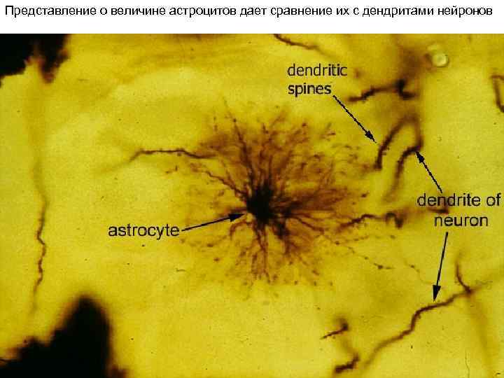 Представление о величине астроцитов дает сравнение их с дендритами нейронов 
