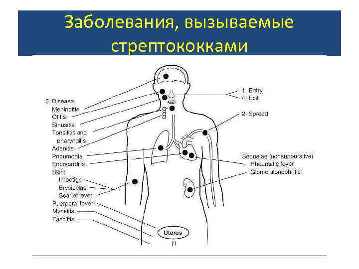 Заболевания, вызываемые стрептококками 