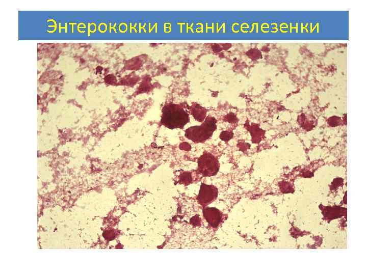 Энтерококки в ткани селезенки 