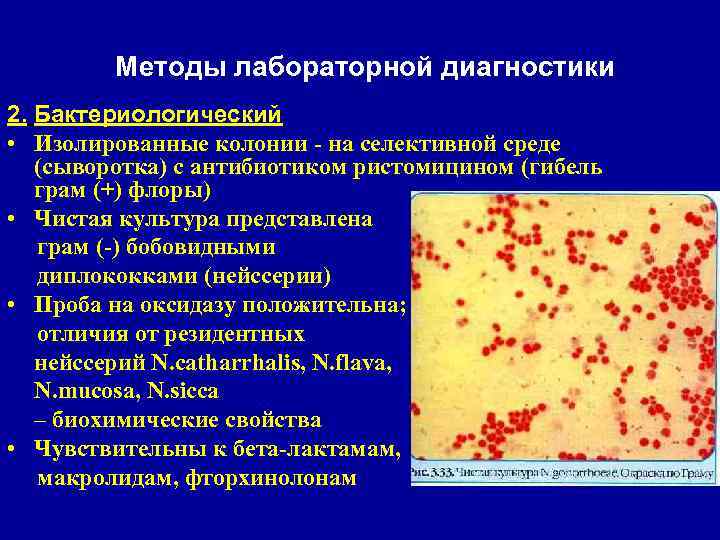 Гонорея презентация дерматовенерология