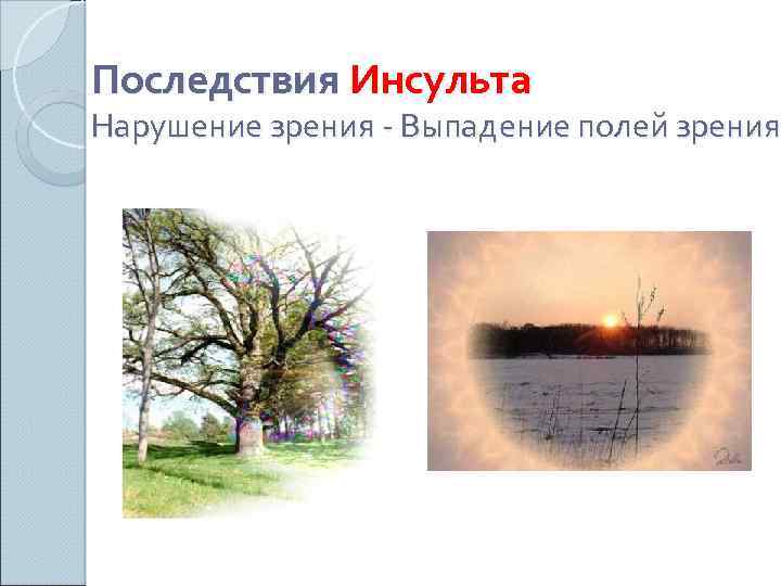 Последствия Инсульта Нарушение зрения - Выпадение полей зрения 