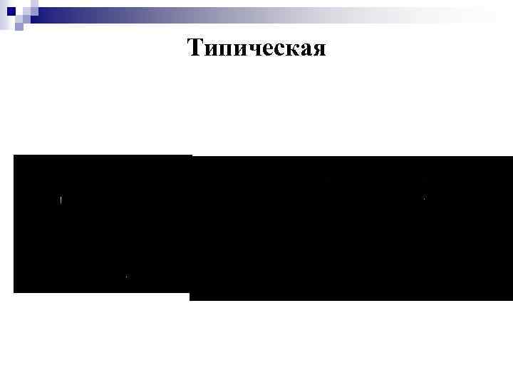 Типическая 