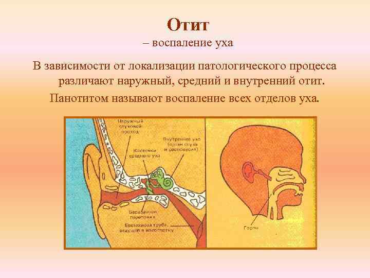 Отит – воспаление уха В зависимости от локализации патологического процесса различают наружный, средний и