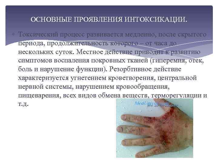ОСНОВНЫЕ ПРОЯВЛЕНИЯ ИНТОКСИКАЦИИ. Токсический процесс развивается медленно, после скрытого периода, продолжительность которого – от