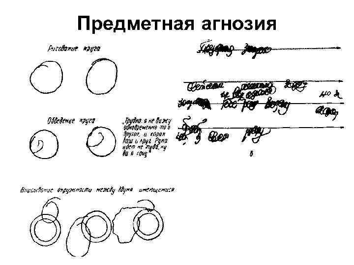 Предметная диагностика. Предметная Зрительная агнозия. Предметная агнозия очаг поражения. Симультанная Зрительная агнозия. Агнозия примеры.